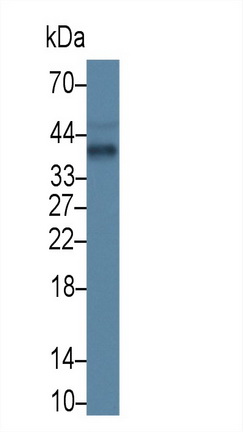 Monoclonal Antibody to Apolipoprotein E (APOE)