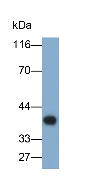 Monoclonal Antibody to Apolipoprotein E (APOE)