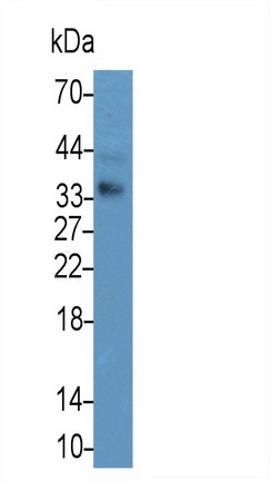 Monoclonal Antibody to Apolipoprotein E (APOE)