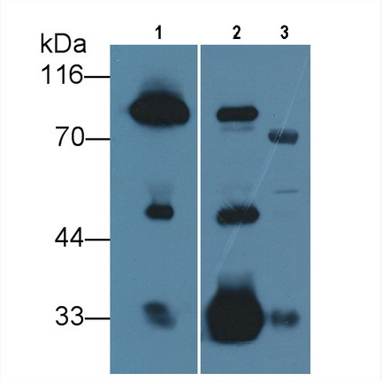 Monoclonal Antibody to Prothrombin Fragment 1+2 (F1+2)