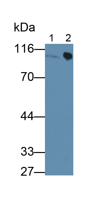 Monoclonal Antibody to Prothrombin Fragment 1+2 (F1+2)