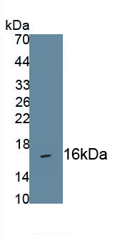 Monoclonal Antibody to C-Type Natriuretic Peptide (CNP)