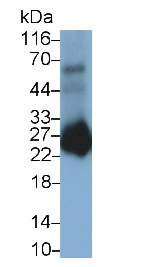 Monoclonal Antibody to Prostaglandin-H2 D-isomerase (PTGDS)