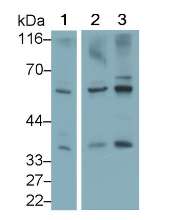 Monoclonal Antibody to Dickkopf Related Protein 1 (DKK1)