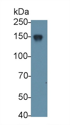 Monoclonal Antibody to Complement Receptor 2 (CD21)