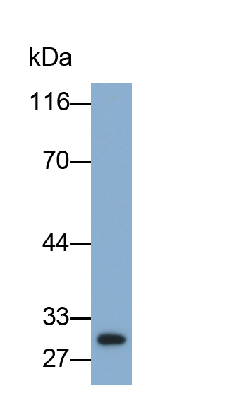 Monoclonal Antibody to Programmed Cell Death Protein 1 (PD1)