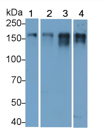 Monoclonal Antibody to Epidermal Growth Factor Receptor (EGFR)