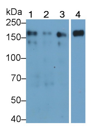 Monoclonal Antibody to Epidermal Growth Factor Receptor (EGFR)