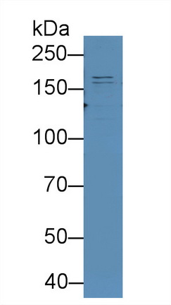 Monoclonal Antibody to Complement C3 Convertase (C3 Convertase)