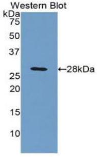 Monoclonal Antibody to C4 Binding Protein Beta (C4BPb)