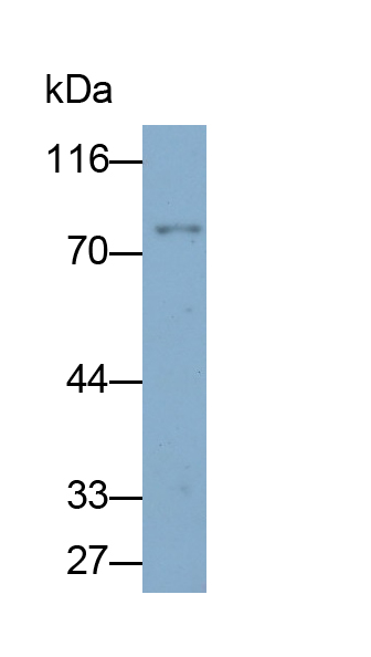 Monoclonal Antibody to Forkhead Box Protein P1 (FOXP1)