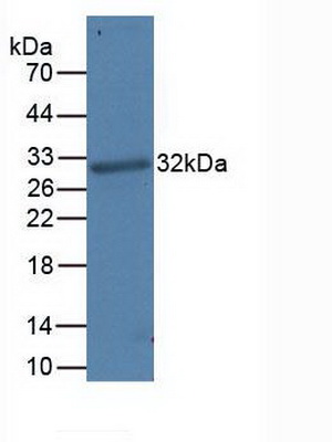 Monoclonal Antibody to Programmed Cell Death Protein 1 Ligand 1 (PDL1)