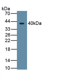 Monoclonal Antibody to Hypoxia Inducible Factor 1 Alpha (HIF1a)