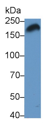 Monoclonal Antibody to Pregnancy Associated Plasma Protein A (PAPPA)