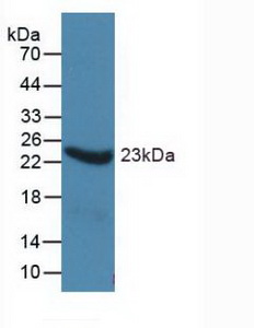 Monoclonal Antibody to Alpha-1-Acid Glycoprotein (a1AGP)