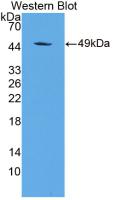 Monoclonal Antibody to Alpha-1-Acid Glycoprotein (a1AGP)