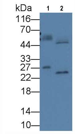 Monoclonal Antibody to Alpha-1-Acid Glycoprotein (a1AGP)