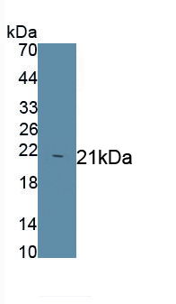 Monoclonal Antibody to Haptoglobin (Hpt)