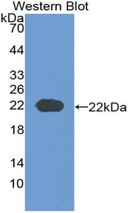 Monoclonal Antibody to Parathyroid Hormone Related Protein (PTHrP)