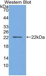 Monoclonal Antibody to Parathyroid Hormone Related Protein (PTHrP)