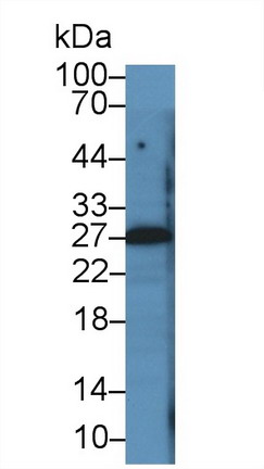 Monoclonal Antibody to Parathyroid Hormone Related Protein (PTHrP)