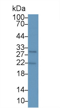 Monoclonal Antibody to Parathyroid Hormone Related Protein (PTHrP)