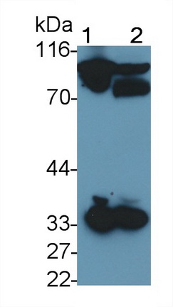 Monoclonal Antibody to Coagulation Factor II (F2)