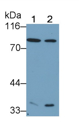 Monoclonal Antibody to Coagulation Factor II (F2)