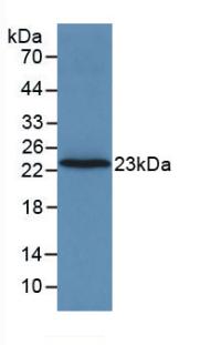 Monoclonal Antibody to Coagulation Factor II (F2)