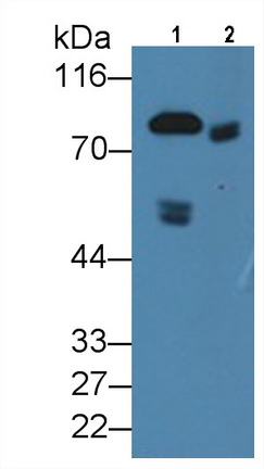 Monoclonal Antibody to Coagulation Factor II (F2)