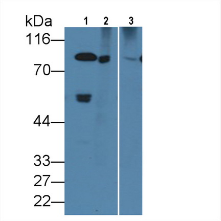 Monoclonal Antibody to Coagulation Factor II (F2)