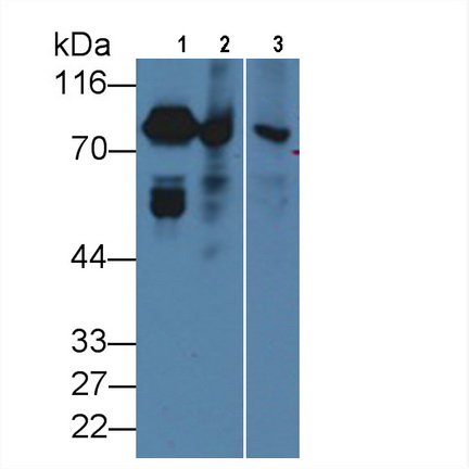 Monoclonal Antibody to Coagulation Factor II (F2)