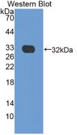 Monoclonal Antibody to C Reactive Protein (CRP)