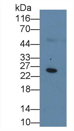 Monoclonal Antibody to C Reactive Protein (CRP)