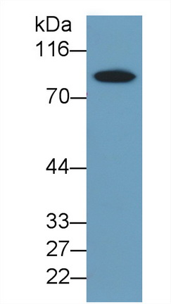 Monoclonal Antibody to Thrombin/Antithrombin Complex (TAT)