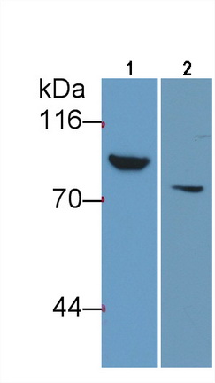 Monoclonal Antibody to Thrombin/Antithrombin Complex (TAT)