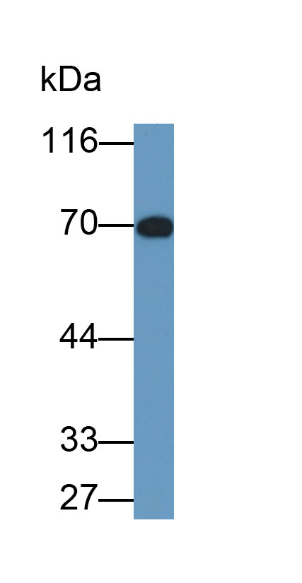 Monoclonal Antibody to Plasmin/Antiplasmin Complex (PAP)