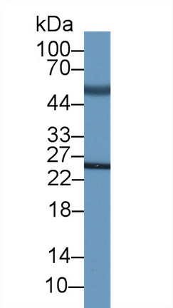 Monoclonal Antibody to Adrenocorticotropic Hormone (ACTH)