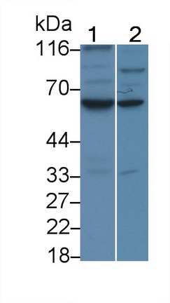 Monoclonal Antibody to Caspase 8 (CASP8)