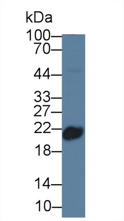 Monoclonal Antibody to Clara Cell Protein 16 (CC16)