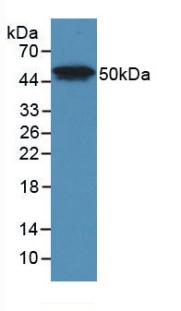 Monoclonal Antibody to Phospholipase A2 Group VII (LpPLA2)