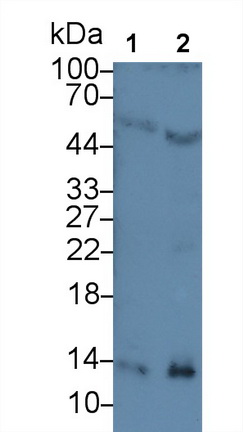 Monoclonal Antibody to Serum Amyloid A (SAA)