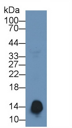 Monoclonal Antibody to Serum Amyloid A (SAA)