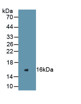 Monoclonal Antibody to Renin (REN)