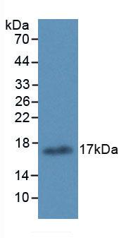 Monoclonal Antibody to Arachidonate-15-Lipoxygenase (ALOX15)