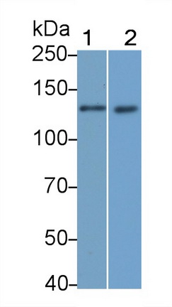 Monoclonal Antibody to Insulin Receptor (INSR)