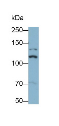 Monoclonal Antibody to Insulin Receptor (INSR)