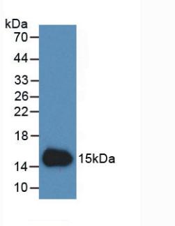 Monoclonal Antibody to Cystatin C (Cys-C)