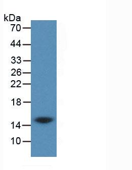 Monoclonal Antibody to Cystatin C (Cys-C)