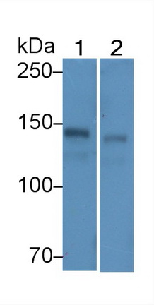 Monoclonal Antibody to Ceruloplasmin (CP)